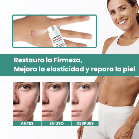Cicatriplus® South Moon - Spray Elimina Cicatrices 50% OFF