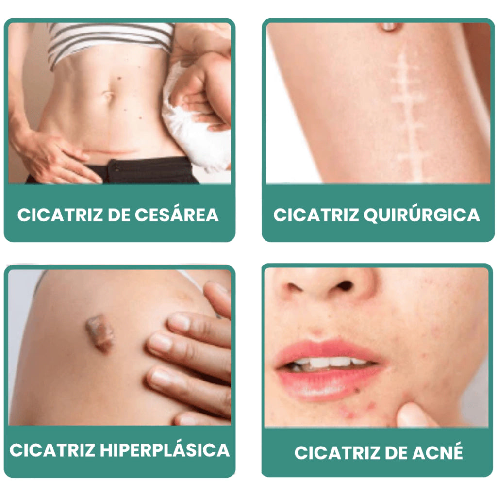 Cicatriplus® South Moon - Spray Elimina Cicatrices 50% OFF