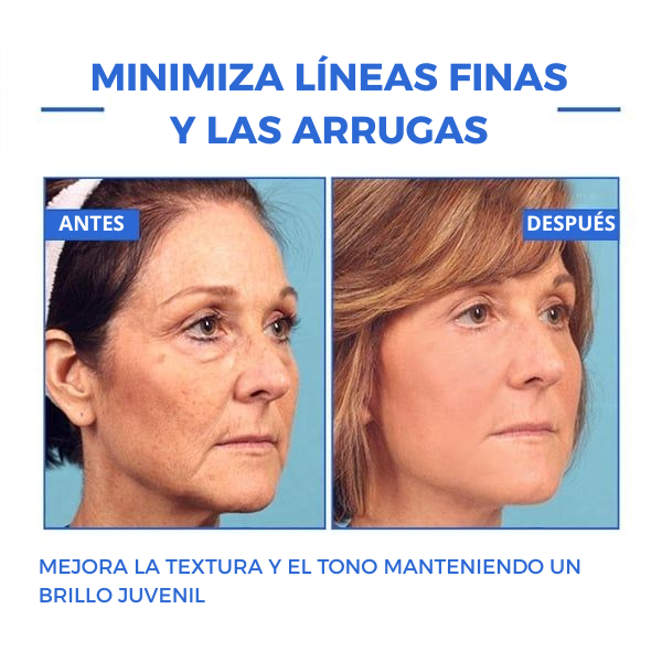 Botox Serum Solution™ - PRODUCTO ORIGINAL
