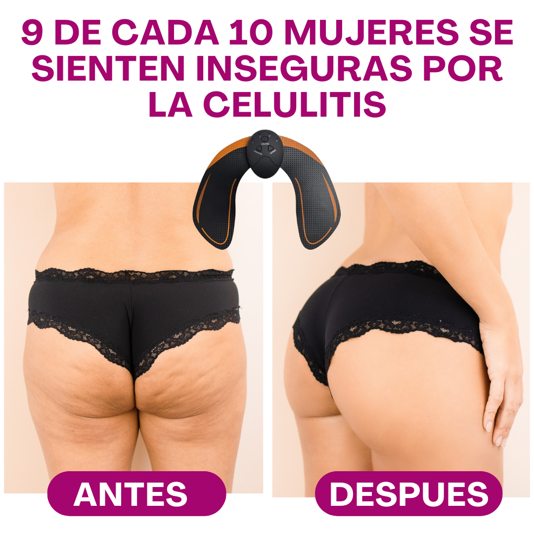 Tonificador EMS Glute Fit™ | Activa, tonifica y eleva tus glúteos sin salir de casa