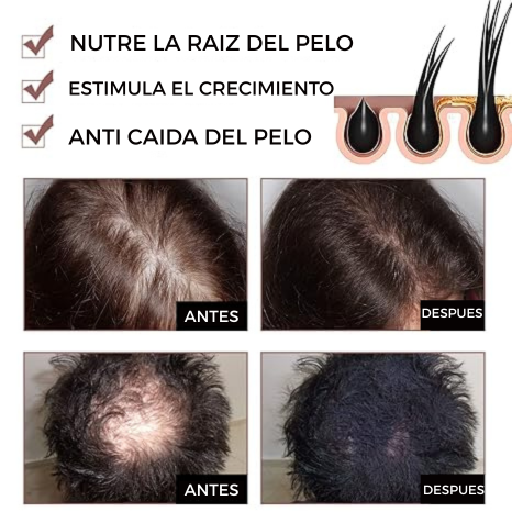 Jabón Japonés He Shou Wu™ ORIGINAL  - Fortalece, previene la caída y evita el crecimiento de canas. PAGA 1 LLEVA 2