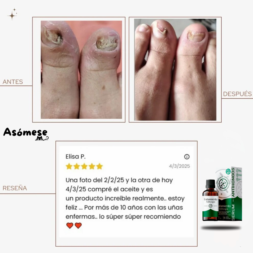 Esmalte Antihongos SERUM ORIGINAL X 30ML - CERTIFICADO POR PODOLOG
