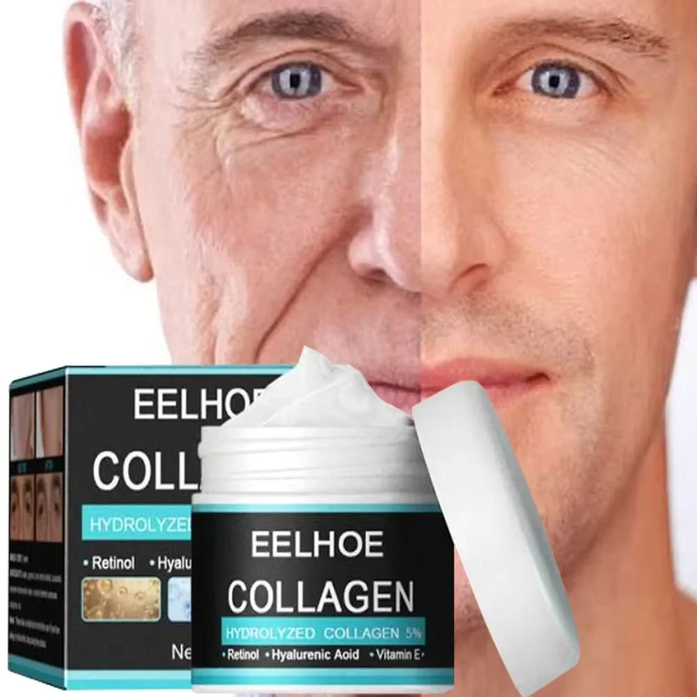 EELHOE® - Crema Antiarrugas Para Hombre 60g - Ayuda a eliminar las arrugas y recuperar la piel joven.