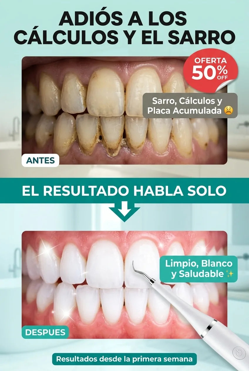 03 antes despues